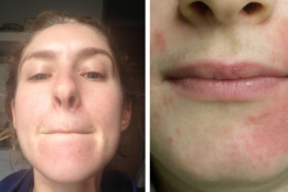 Does Vaseline Ever Expire? Unpacking Its Shelf Life and What expiration Really Means